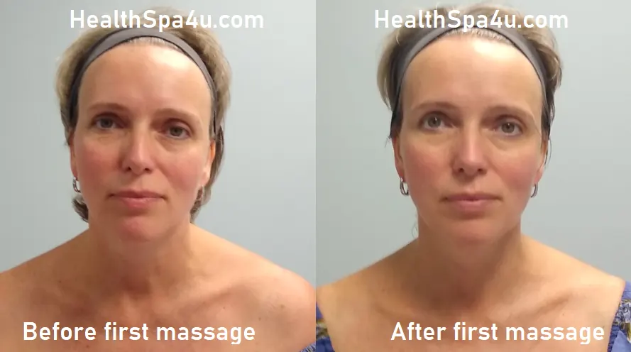 Before and After massage Client_1