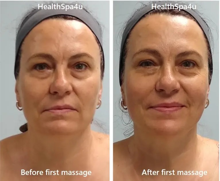 Before and After Massage Client _5